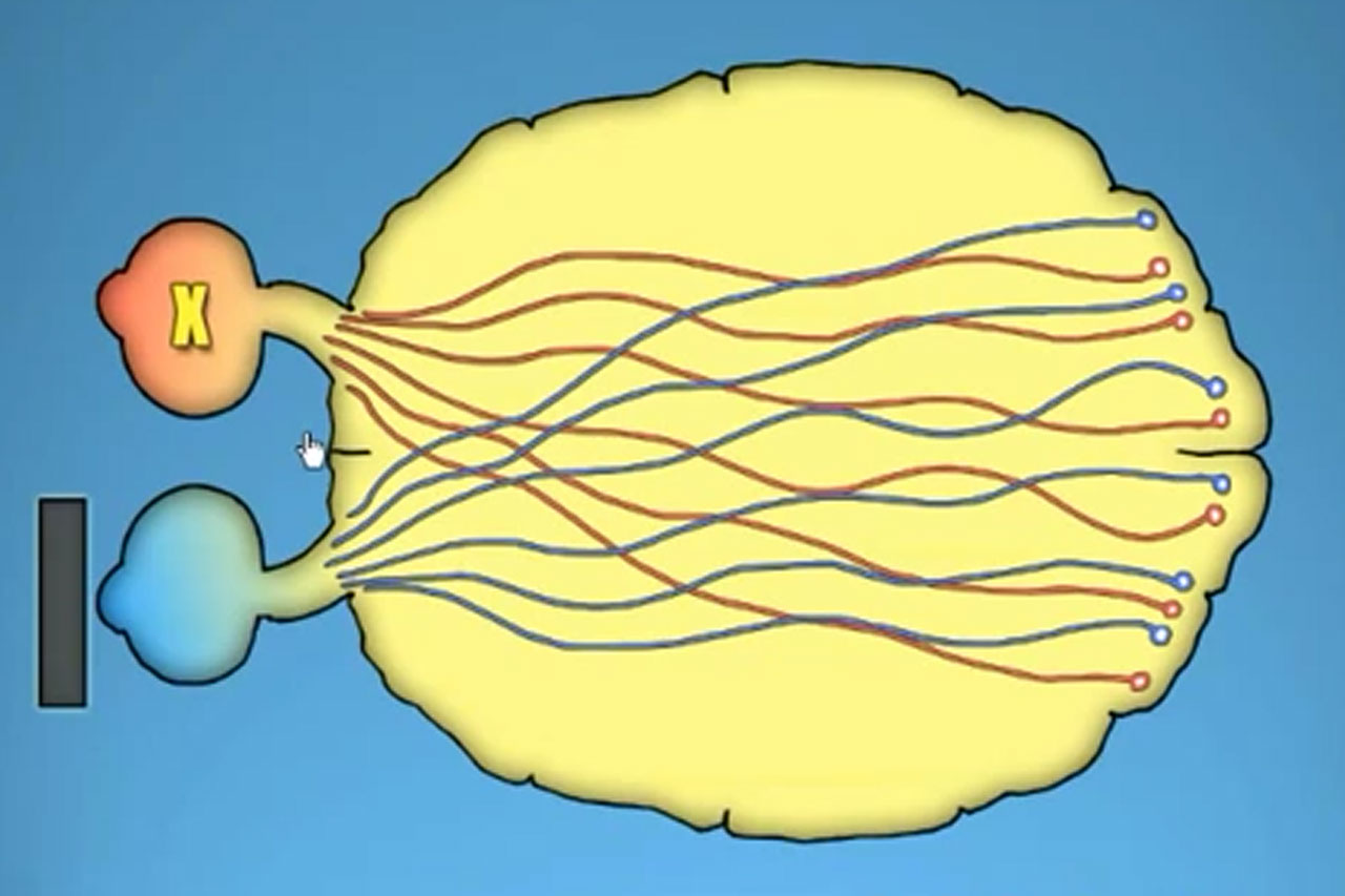 Amblyopia Video Image